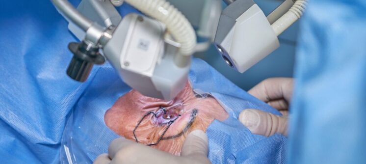 Blog-1-Eye-Specialists-Eye-Align-1024x834